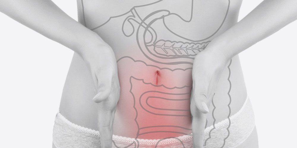 Εκκολπώματα Εντέρου