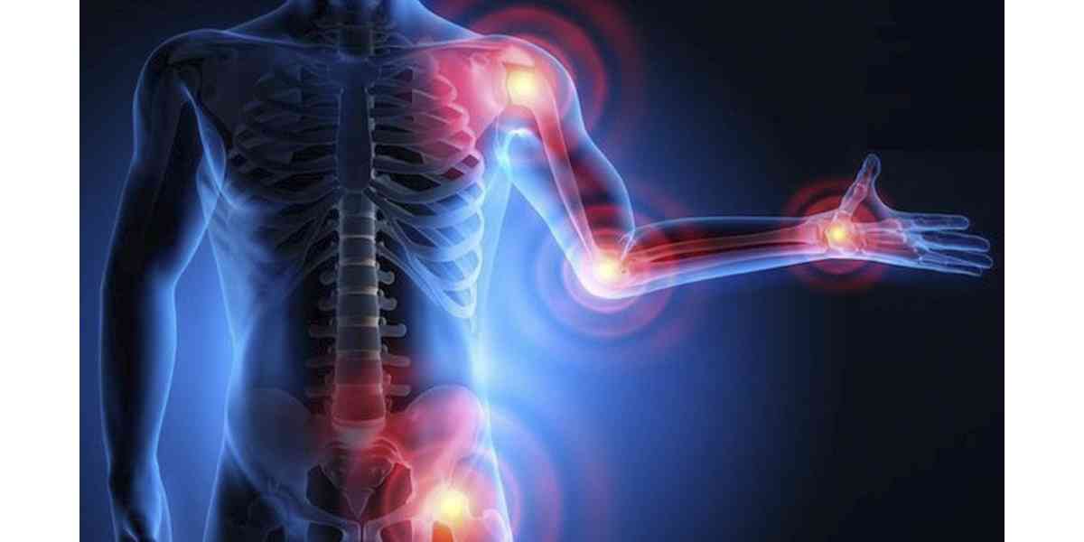 IRI BEYOND - Η φλεγμονή τι είναι; Eξετάσεις που τη δείχνουν. Ποιες τροφές καταπολεμούν τις φλεγμονές;